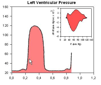 Ventricular Pressure